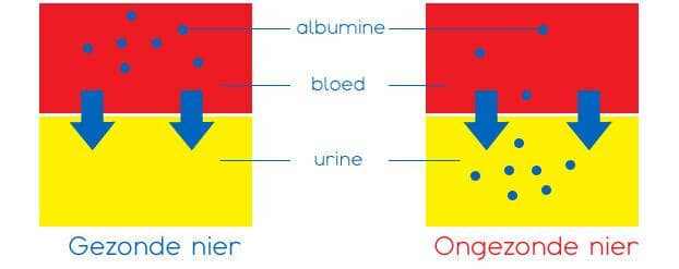Infographic van Albumine, in een gezonde nier zit er geen albumine in de urine