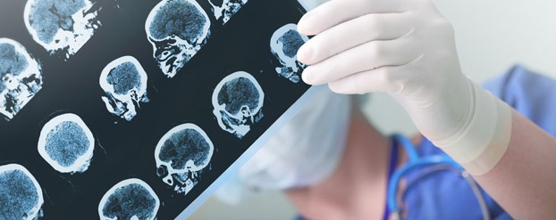 Hoe beïnvloeden de hersenen eetlust? Shutterstock: sfam photo
