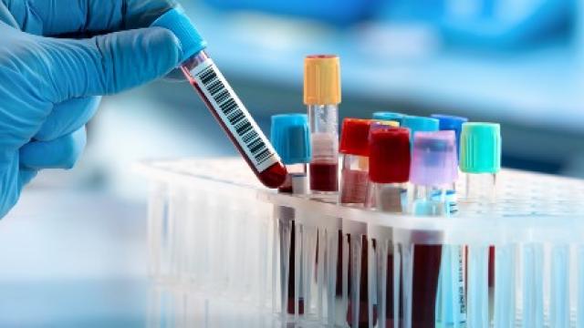 Lab met bloedsamples