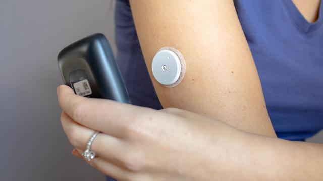 Vrouw scant continue glucose monitor op arm