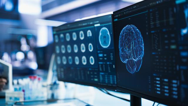 Beeldschermen met afbeeldingen van hersenscans