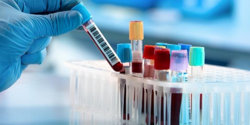 Lab met bloedsamples