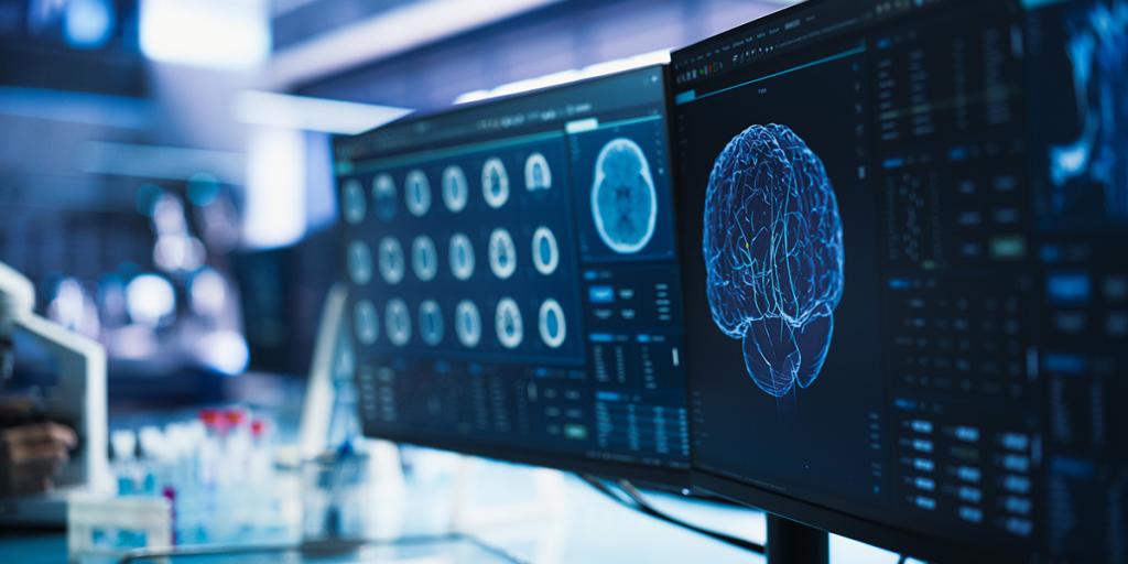 Beeldschermen met afbeeldingen van hersenscans