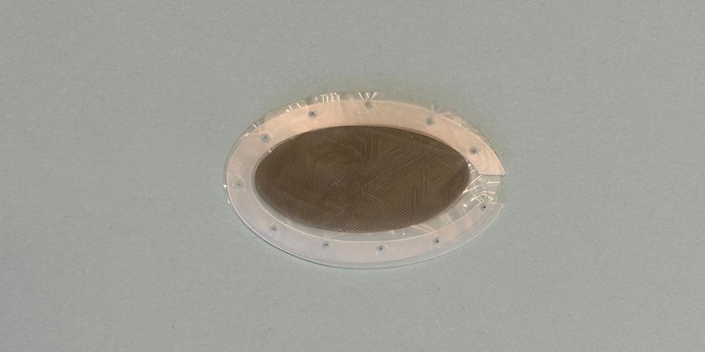 Verpakking voor nieuwe insulineproducerende cellen, doorzichtige ovaal zakje met rasterpatroon