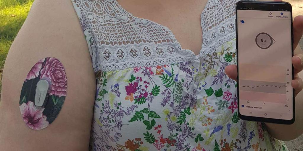 Foto van vrouw met realtime continue glucosemeter