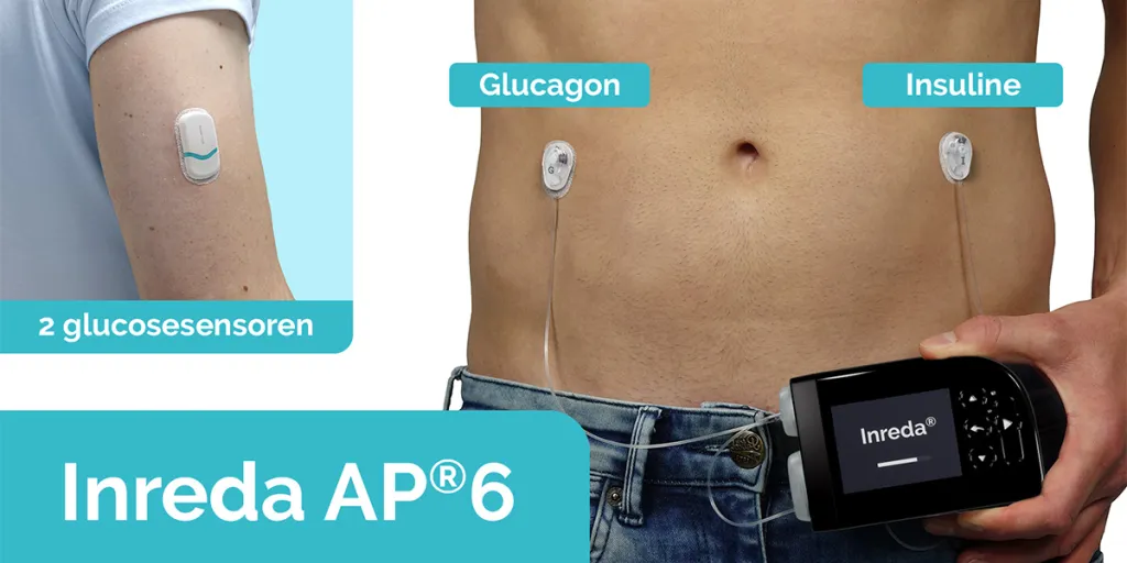 Prototype Inreda kunstalvleesklier in hand van persoon met diabetes met blote buik met sensoren erop
