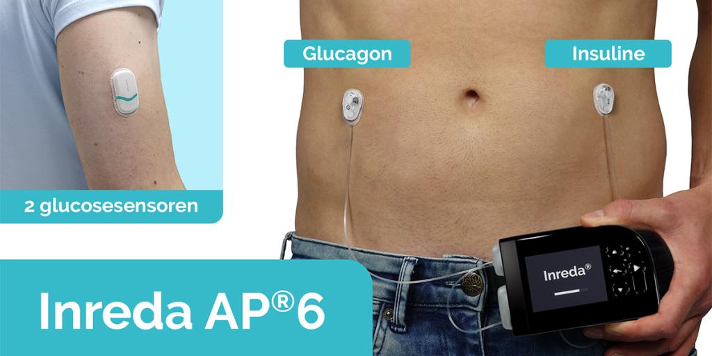 Prototype Inreda kunstalvleesklier in hand van persoon met diabetes met blote buik met sensoren erop