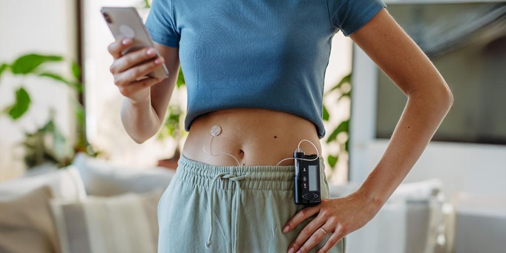 Vrouw met een insulinepomp kijkt op haar mobiel voor DIY loopen