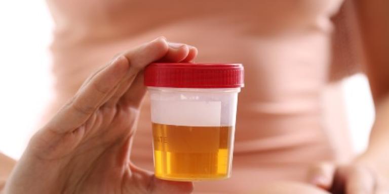 Urinetest thuis