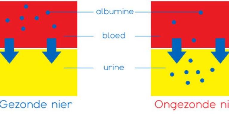 Infographic van Albumine, in een gezonde nier zit er geen albumine in de urine