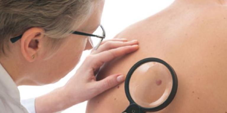 foto huid shutterstock Alexander Raths