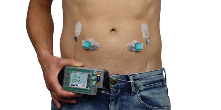 Kunstalvleesklier van Inreda op lichaam