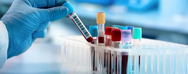 Lab met bloedsamples