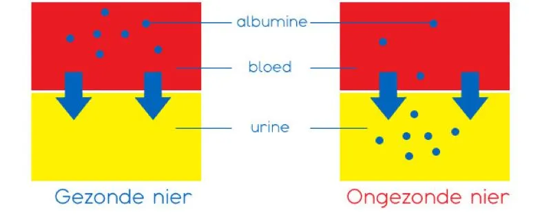 Infographic van Albumine, in een gezonde nier zit er geen albumine in de urine