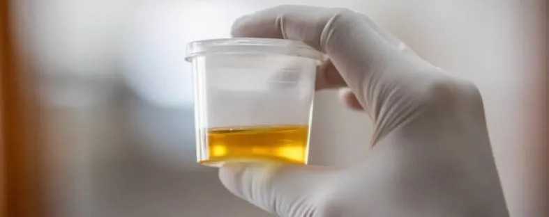 Eiwit it urine - Shutterstock plenoy m