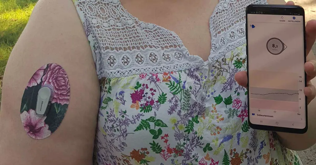 Foto van vrouw met realtime continue glucosemeter