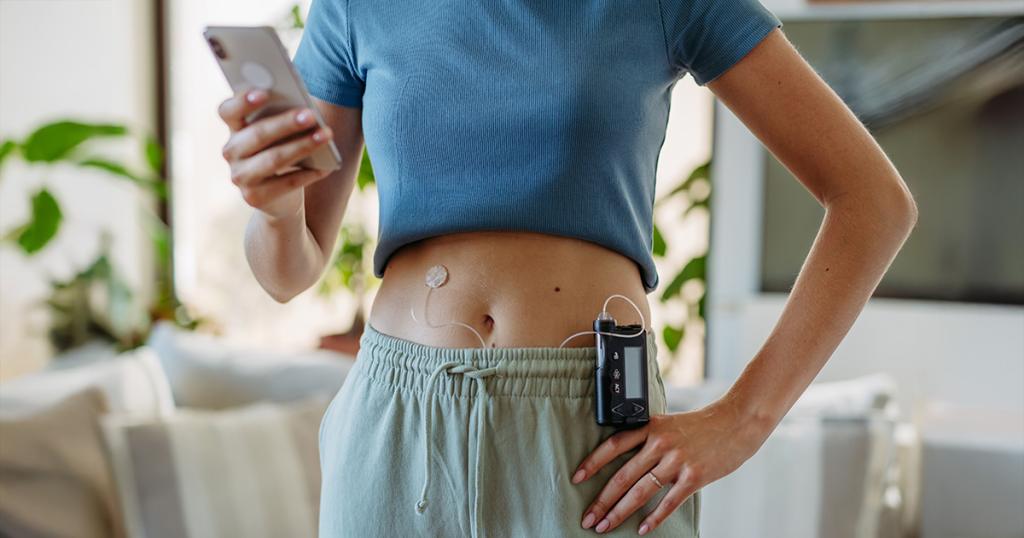 Vrouw met een insulinepomp kijkt op haar mobiel voor DIY loopen